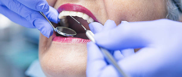 Best Emergency Denture Repair in Lanham, MD
